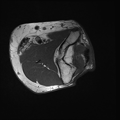 Click on the Serie image to view the images of Wieszt, Gnter